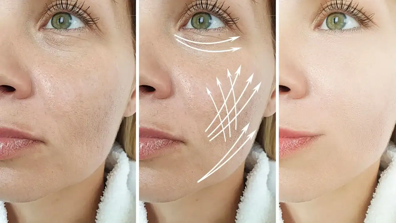 Can One Treatment Really Tackle More Than One Skin Concern Caversham?