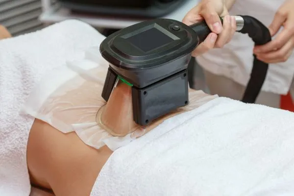 Image of person having fat freezing treatment to help weight gain Caversham