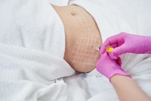 image of fat dissolving injections on love handles to help combat weight gain Caversham