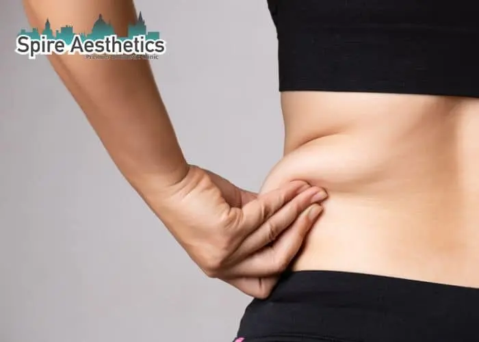 Image of woman pinching fat on their hips Caversham. Fat Freezing treatment