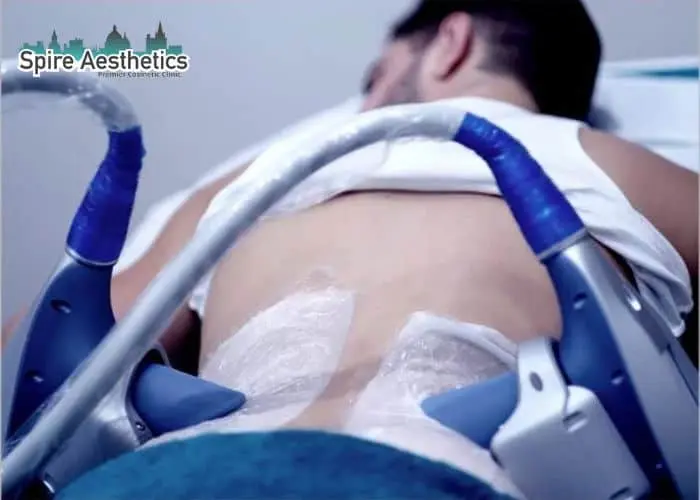 Man having fat freezing treatment done on love handles before a competitions Caversham to create a sculpted look.