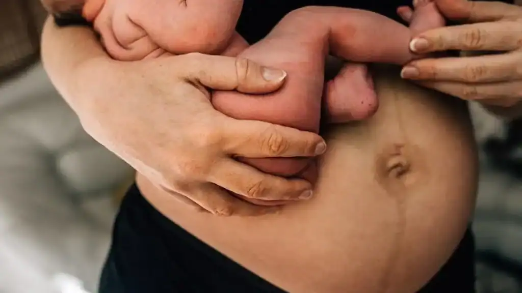 Why Is My Stomach Still Big After Pregnancy Caversham?